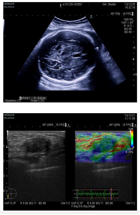 Ultrasonografy stacjonarne wielonarządowe - USG FUJIFILM ARIETTA V70