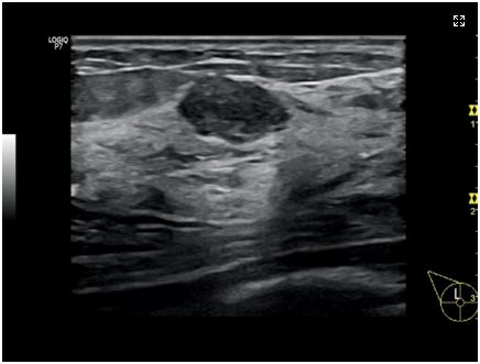 Ultrasonografy stacjonarne wielonarządowe - USG GE Healthcare LOGIQ P7