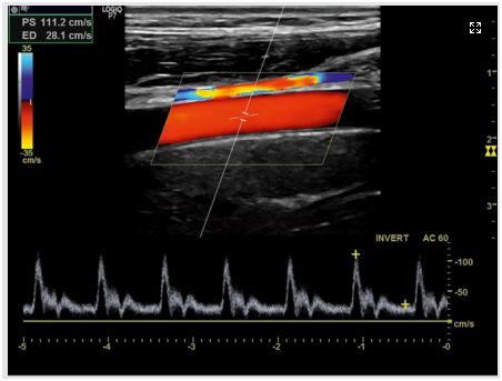 Ultrasonografy stacjonarne wielonarządowe - USG GE Healthcare LOGIQ P7