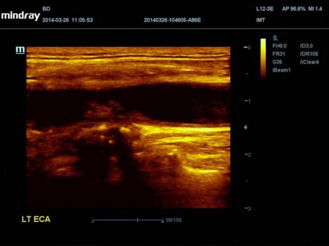 Ultrasonografy stacjonarne wielonarządowe - USG MINDRAY DC-70