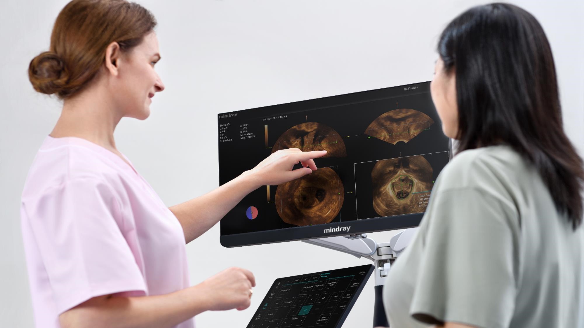 Ultrasonografy stacjonarne wielonarządowe - USG MINDRAY Nuewa I9