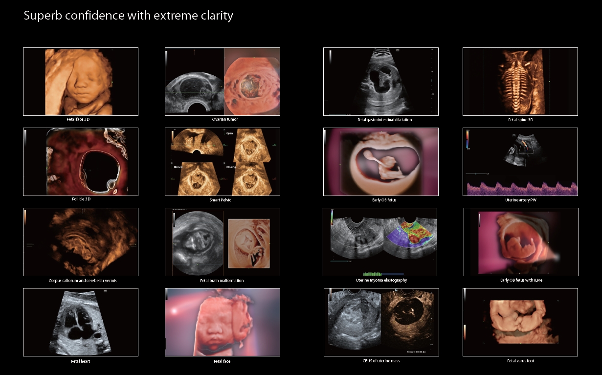 Ultrasonografy stacjonarne wielonarządowe - USG MINDRAY Nuewa I9