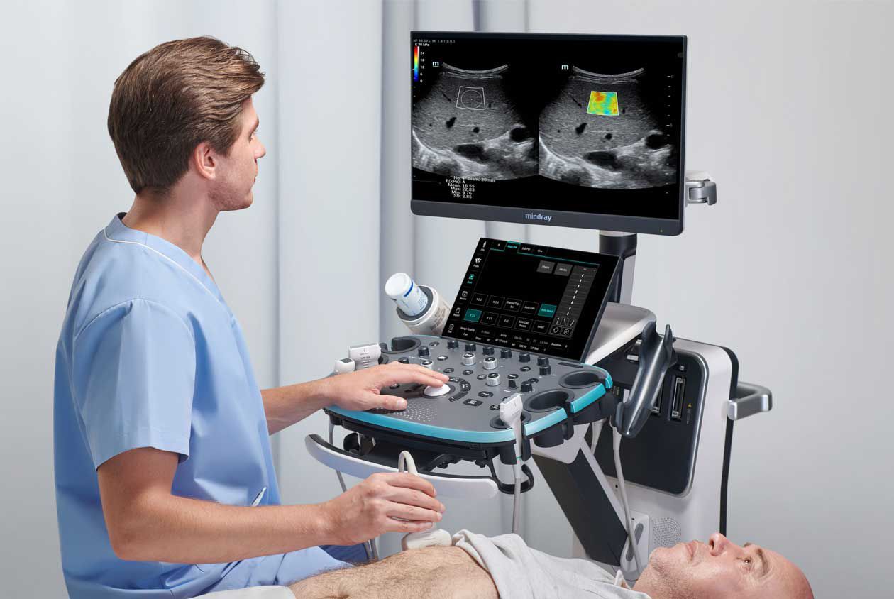 Ultrasonografy stacjonarne wielonarządowe - USG MINDRAY Resona I8