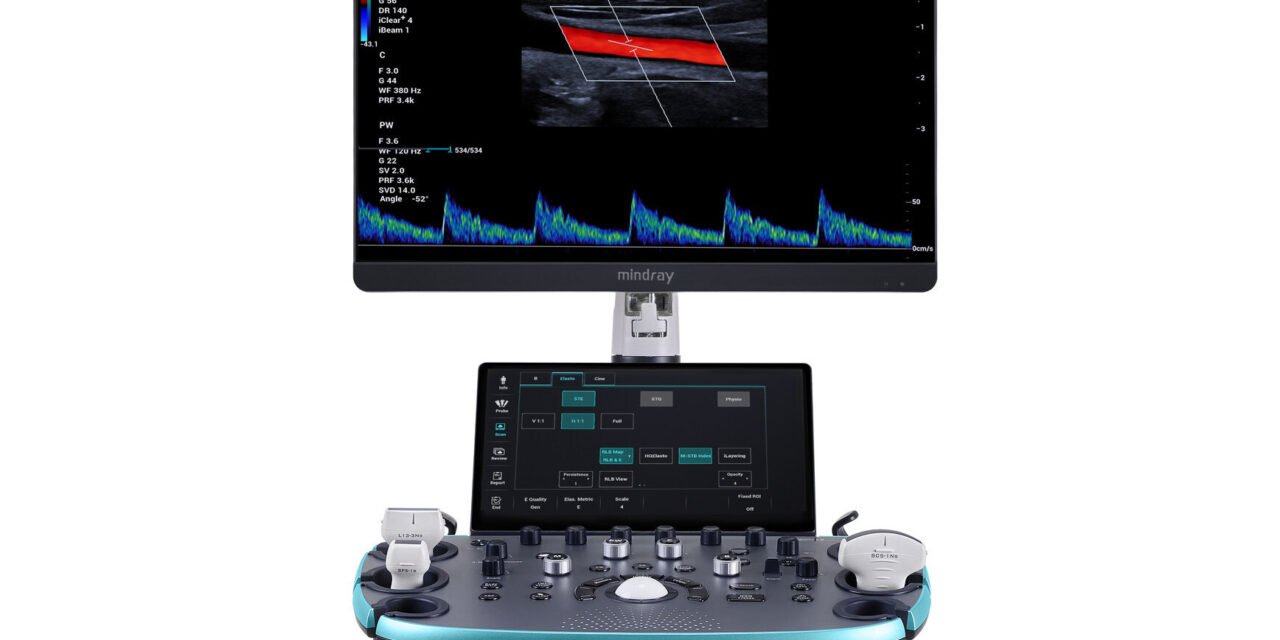 Ultrasonografy stacjonarne wielonarządowe - USG MINDRAY Resona I8
