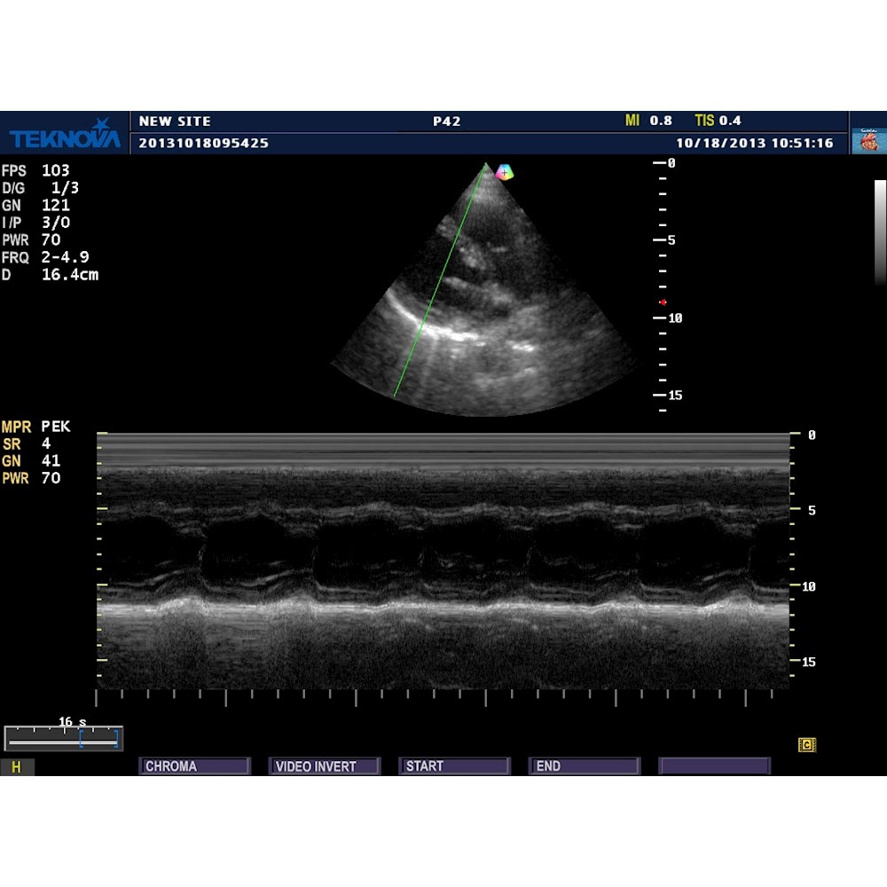 Ultrasonografy stacjonarne wielonarządowe - USG Teknova TH 5500 Expert