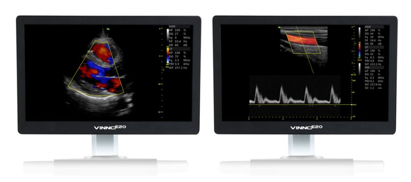 Ultrasonografy stacjonarne wielonarządowe - USG Vinno Vinno E20