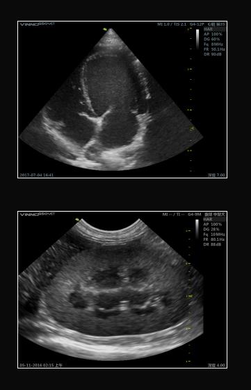 Ultrasonografy stacjonarne wielonarządowe - USG Vinno VINNO G55