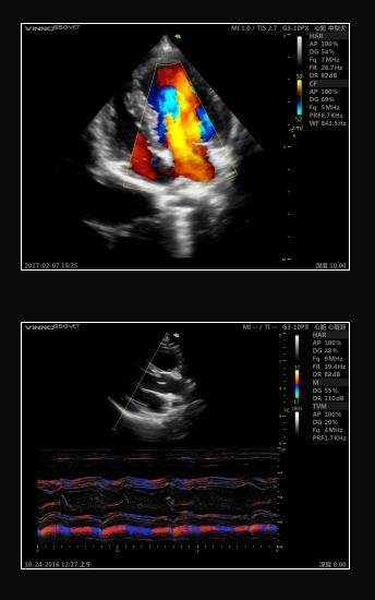 Ultrasonografy stacjonarne wielonarządowe - USG Vinno VINNO G55