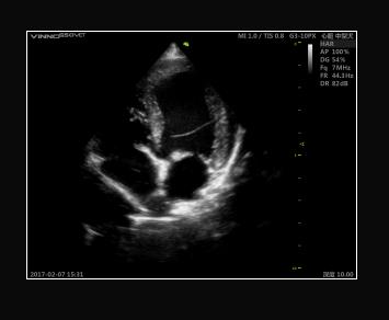 Ultrasonografy stacjonarne wielonarządowe - USG Vinno VINNO G55