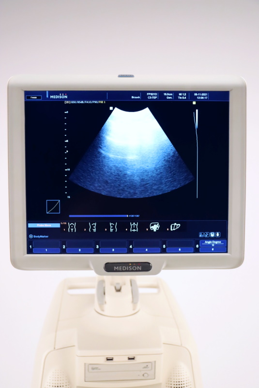 Ultrasonografy wielonarządowe używane B/D Medison SONOACE X8 - Praiston rekondycjonowany
