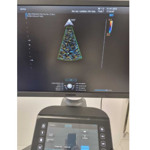 Ultrasonografy wielonarządowe używane B/D SAMSUNG HS70 - Medtex rekondycjonowany