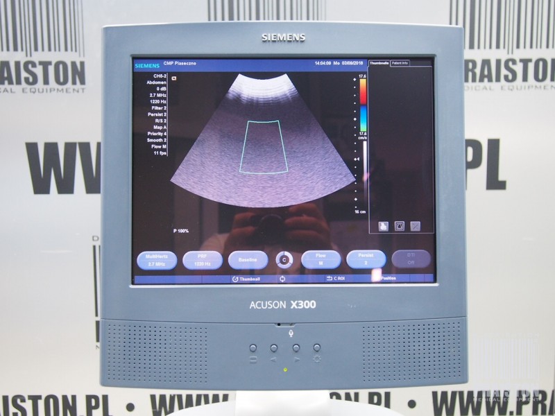 Ultrasonografy wielonarządowe używane B/D Siemens Acuson X300 - Praiston rekondycjonowany