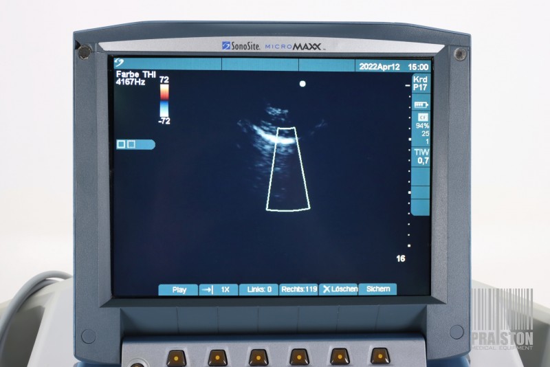 Ultrasonografy wielonarządowe używane B/D Sonosite Micromaxx - Praiston rekondycjonowany
