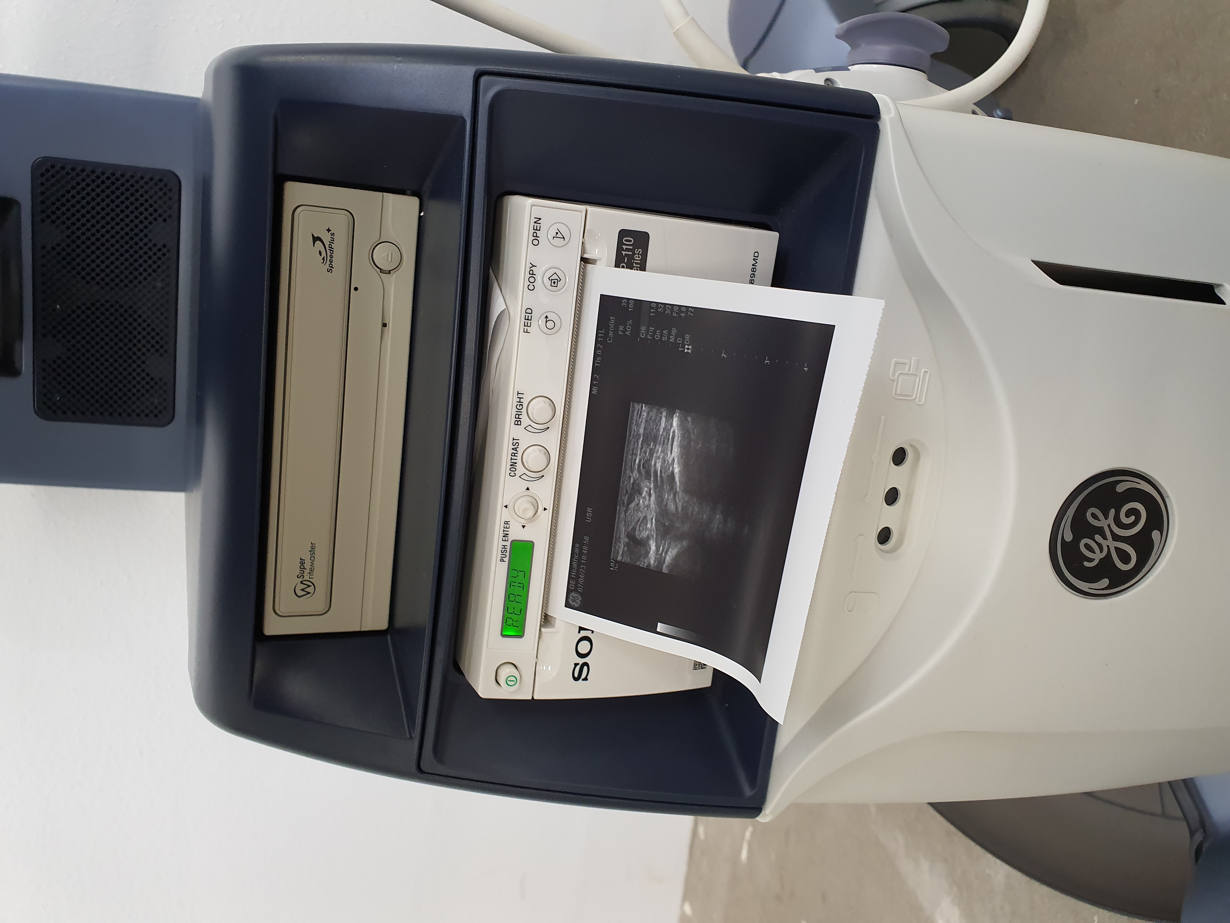 Ultrasonografy wielonarządowe używane GE Healtcare GE Logiq S7 Pro - medsystems rekondycjonowany