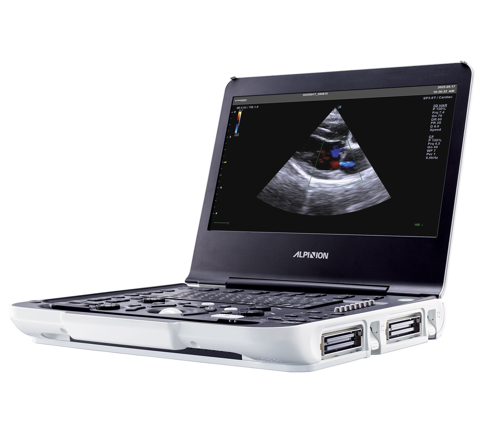 Ultrasonografy wielonarządowe weterynaryjne - USG Alpinion X-CUBE i9 VET