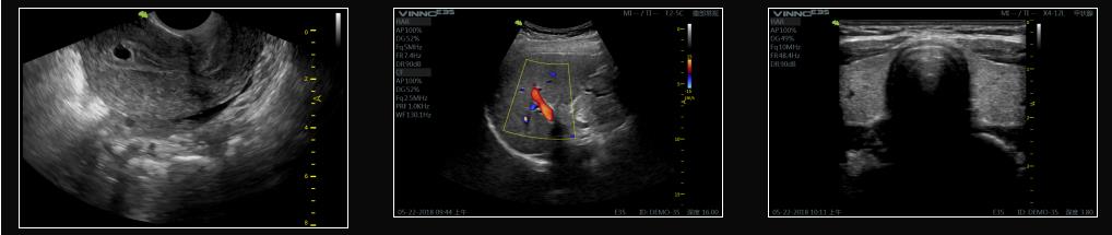 Ultrasonografy wielonarządowe weterynaryjne - USG Vinno E35 VET