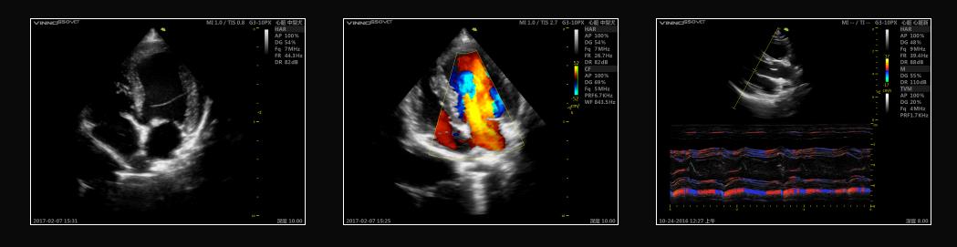 Ultrasonografy wielonarządowe weterynaryjne - USG Vinno G55 VET