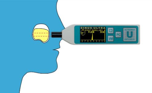 Ultrasonografy zatok EntLab SinusUltra