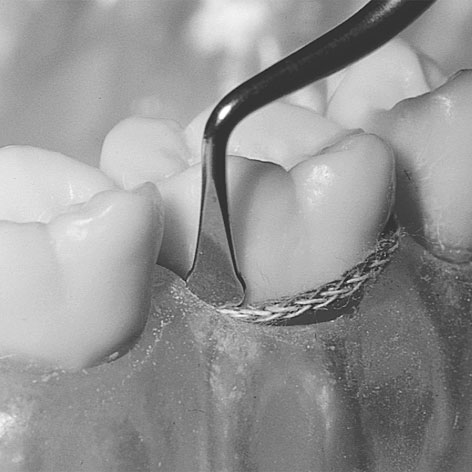 Upychadła stomatologiczne LM-Instruments Upychacz nitki retrakcyjnej