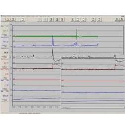 Uroflowmetry MEDKONSULT DanFlow 2000