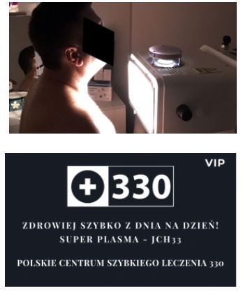 Urządzenia do fototerapii urologicznej Super Plasma JCH33