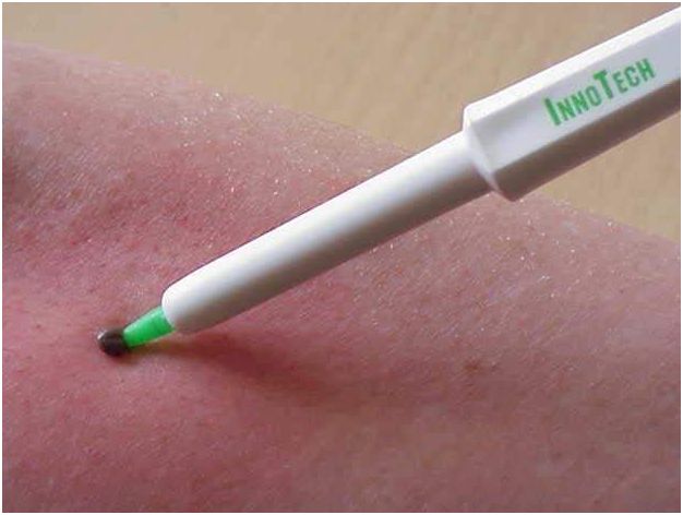 Urządzenia do usuwania kleszczy Innotech Sweden Trix lasso