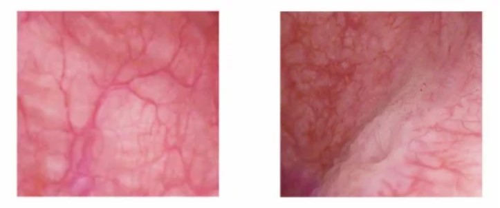 Videocystoskopy B/D TU-CY5832 / TU-CY5230 / TU-CY4826