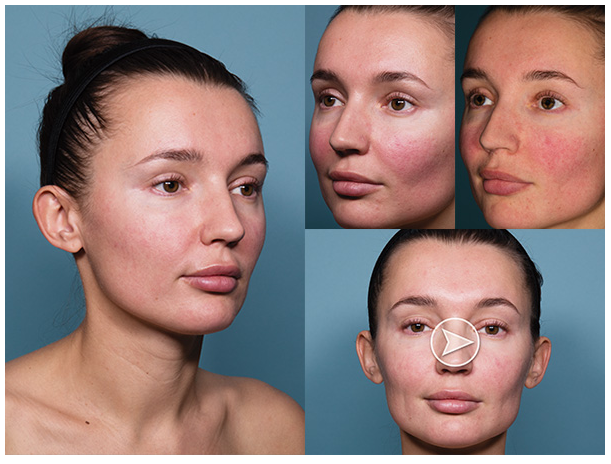 Videodermatoskopy CANFIELD INTELLISTUDIO