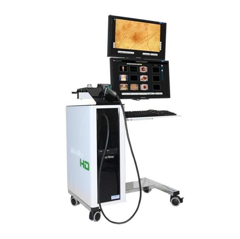 Videodermatoskopy DERMA MEDICAL MoleMax HD