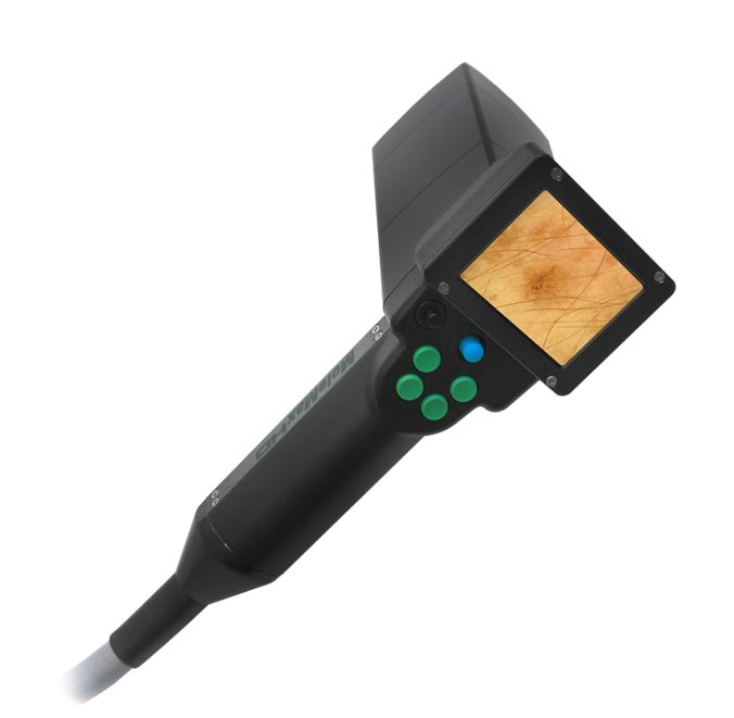 Videodermatoskopy DERMA MEDICAL MoleMax HD