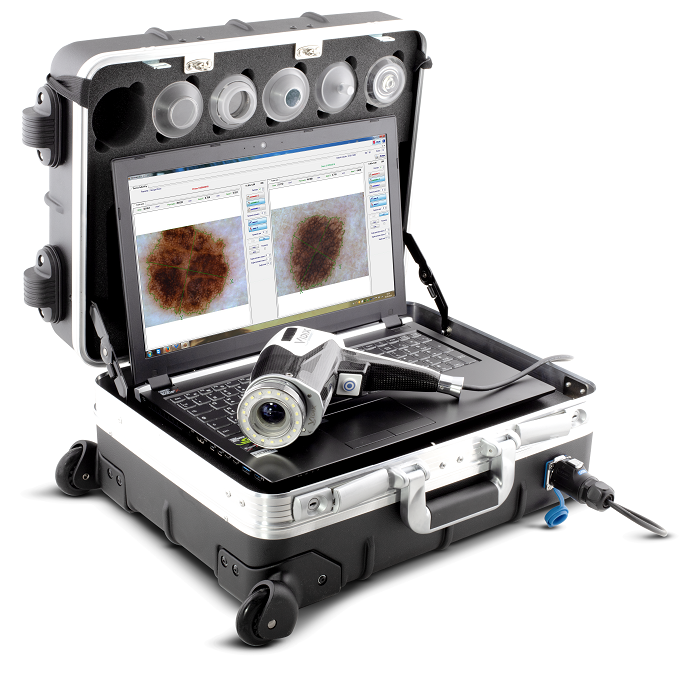 Videodermatoskopy Vidix Vidix 4