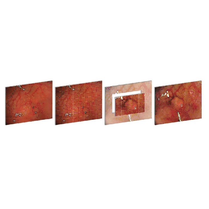 Videokolonoskopy EndoChoice Fuse C38s Slim