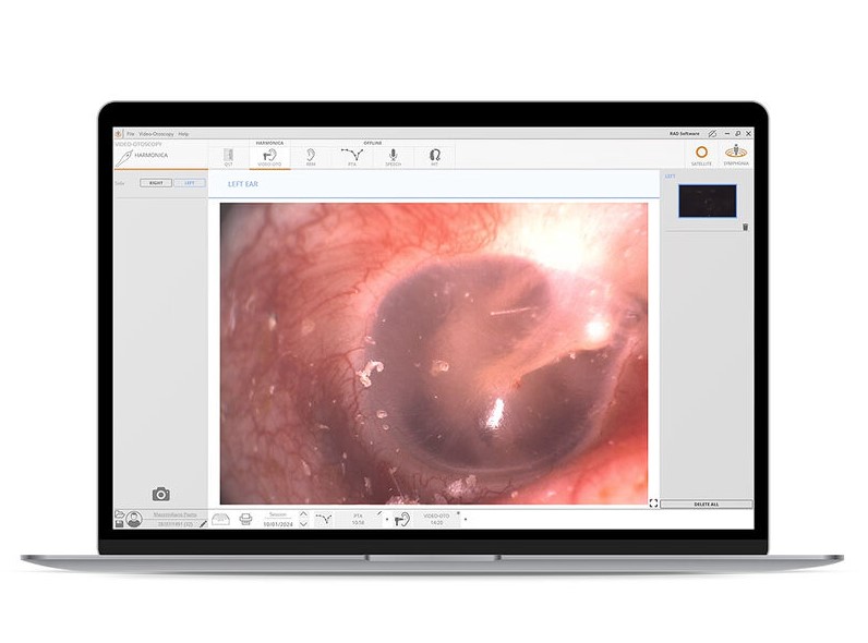 Videootoskopy Inventis Harmonica