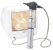 Videootoskopy Welch Allyn CompacVideo z rękojeścią litowo-jonową