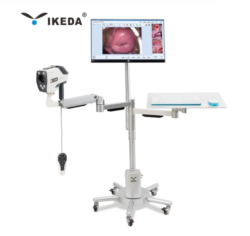 Wideokolposkopy (videokolposkopy) IKEDA Ikeda