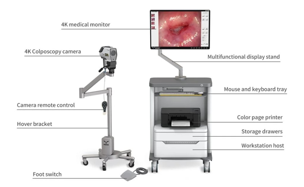Wideokolposkopy (videokolposkopy) IKEDA Ikeda