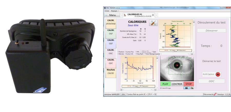 Wideonystagmografy - VNG FRAMIRAL VNG