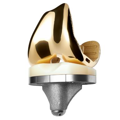 Wkładki endoprotez stawu kolanowego PERMEDICA ORTHOPAEDICS Prime Flex