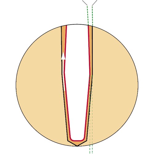 Wkłady pasywne - protetyczne Anthogyr Fibio Core włókno szklane set
