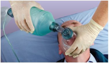 Worki samorozprężalne (resuscytatory) INTERSURGICAL Samorozprężalne systemy do resuscytacji (BVM)