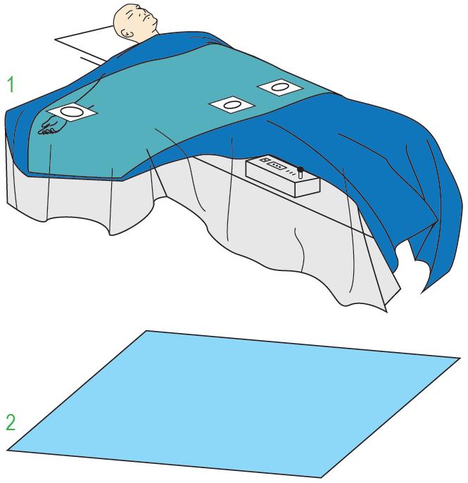 Zestawy do kardiologii – obłożenia pola operacyjnego JKT/MOLNLYCKE 380145