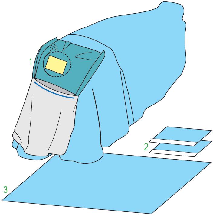 Zestawy do neurochirurgii – obłożenia pola operacyjnego JKT/MOLNLYCKE Zestaw do zabiegów neurochirurgicznych II 380328