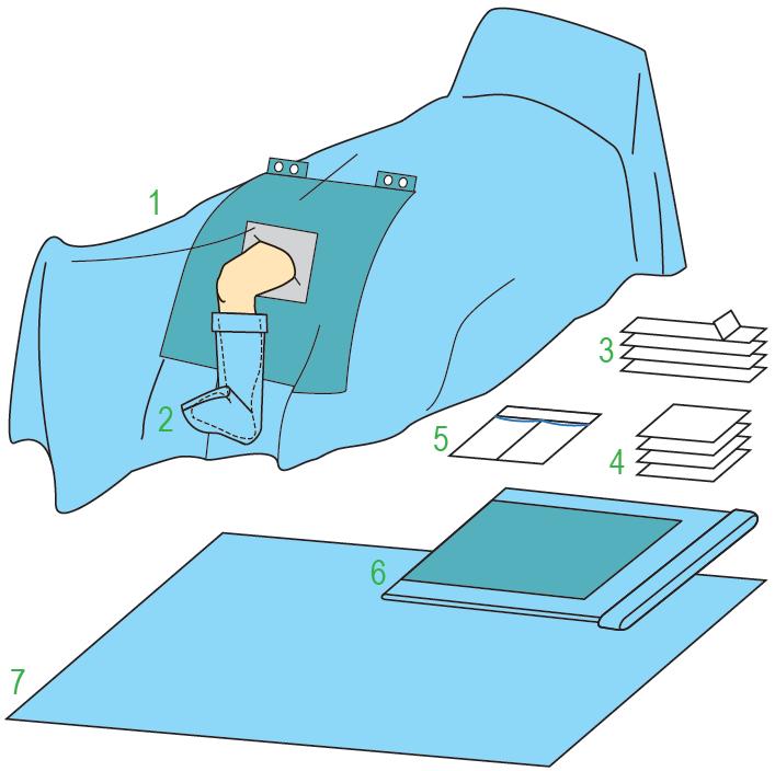 Zestawy do ortopedii – obłożenia pola operacyjnego JKT/MOLNLYCKE Zestaw do artroskopii II 380279