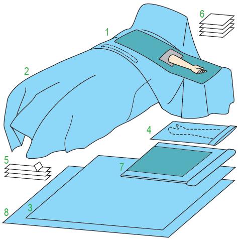 Zestawy do ortopedii – obłożenia pola operacyjnego JKT/MOLNLYCKE Zestaw do operacji na kończynie górnej I 380357