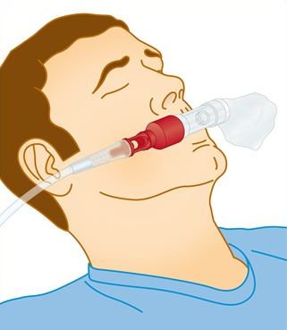 Zestawy do podawania tlenu do intubacji Flexicare Medical 032-10-540 / 032-10-640 / 032-10-740