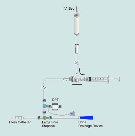 Zestawy do pomiaru ciśnienia śródbrzusznego Biometrix IAP