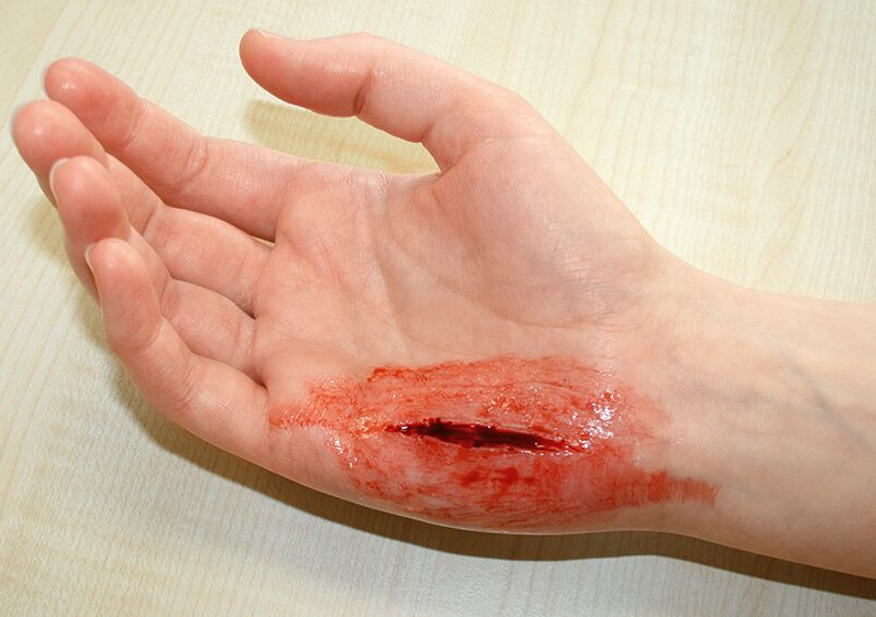 Zestawy do pozoracji ran 3B Scientific WS02