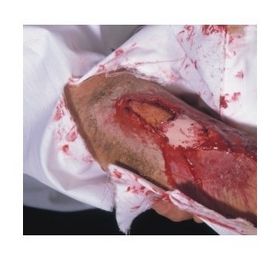 Zestawy do pozoracji ran Kryolan Rana złamanie otwarte z latexu