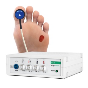 Aparaty do diagnostyki naczyń krwionośnych chorych na cukrzycę