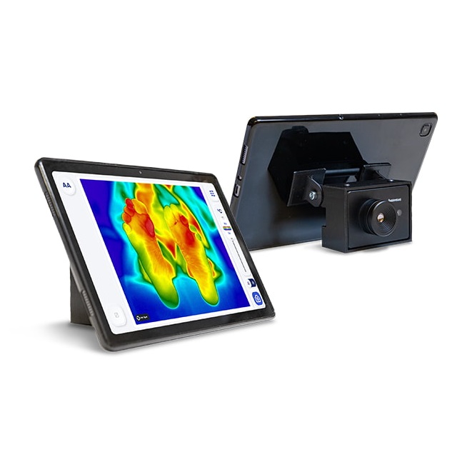 Kamery termograficzne do diagnostyki pacjentów